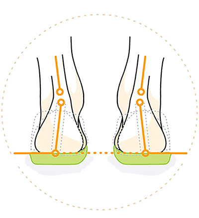 Minden, Amit Tudni Kell a Szupinált Cipőkről
